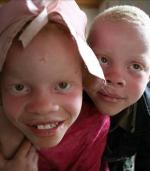 La caza de albinos en África